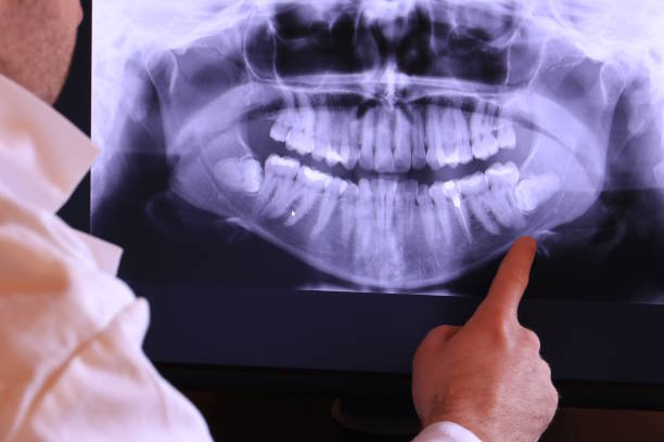 Best Cracked Tooth Emergency Dentist  in Polson, MT